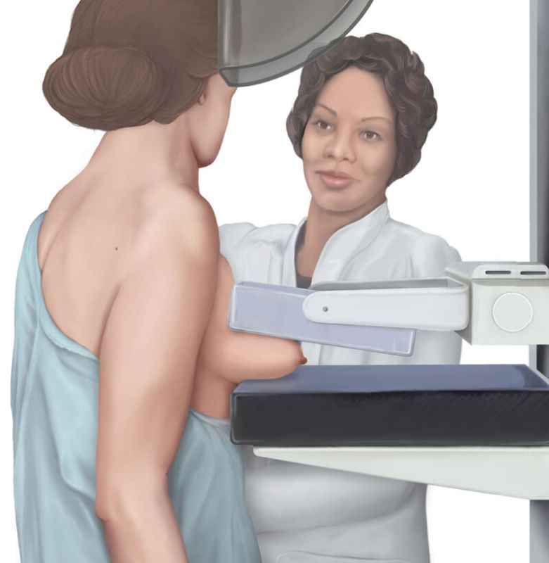 Mamografija dojki