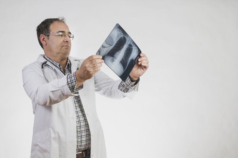 Šta je fraktura rebara?