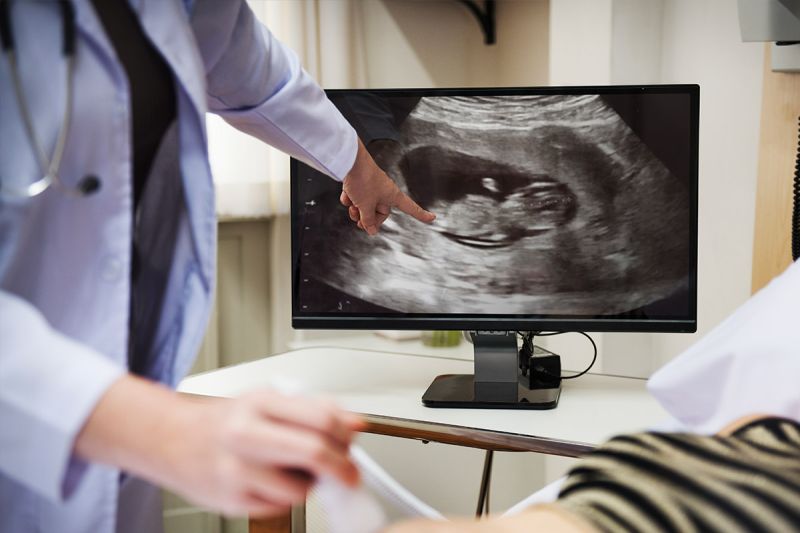 Šta je vanmaterična trudnoća?