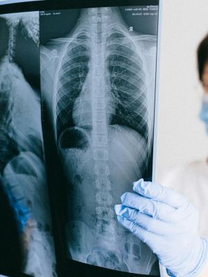 MSCT snimanje grudnog koša