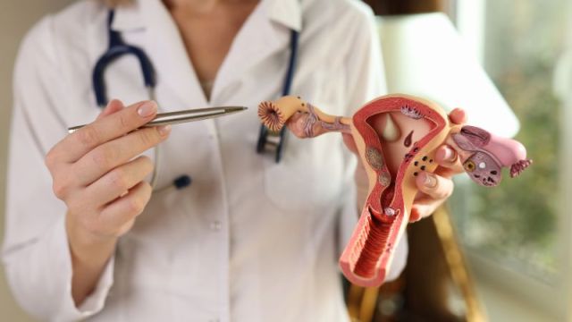 Teratom jajnika: vodič kroz dijagnozu i terapiju