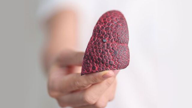 Adenom jetre: simptomi, uzroci i lečenje