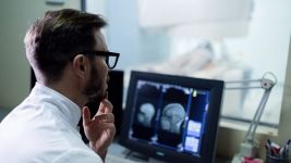 Angiosarkom: Retki tip raka krvnih sudova