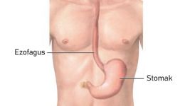 Ezofagitis: Kako prepoznati i kontrolisati upalu jednjaka