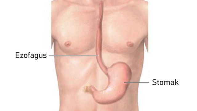 Ezofagitis: Kako prepoznati i kontrolisati upalu jednjaka Ezofagitis: Kako prepoznati i kontrolisati upalu jednjaka