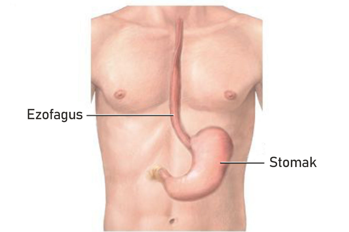 Ezofagitis