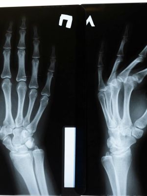 MSCT snimanje zglobova