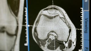 Kako magnetna rezonanca i biomarkeri zajedno pomažu u preciznijoj proceni rizika od raka prostate Kako magnetna rezonanca i biomarkeri zajedno pomažu u preciznijoj proceni rizika od raka prostate