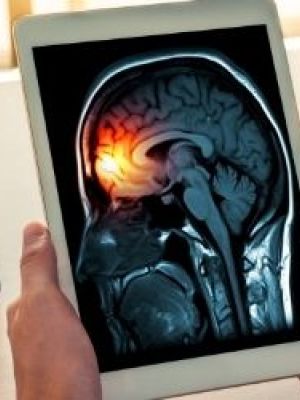 Neurohirurški specijalistički pregled