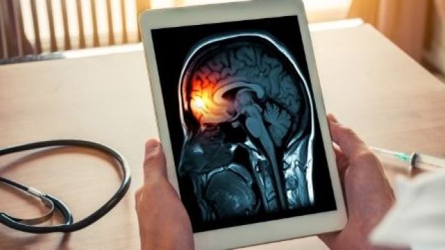 Neurohirurgija Neurohirurgija