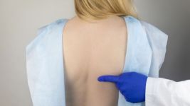 Kifoza - vodič kroz dijagnozu i lečenje